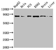 Western Blot Positive WB detected in: HepG2 whole cell lysate, Hela whole cell lysate, PC-3 whole cell lysate, K562 whole cell lyaste, Mouse brain tissue, Rat liver tissue All lanes: STAT4 antibody at 1µg/ml Secondary Goat polyclonal to rabbit IgG...