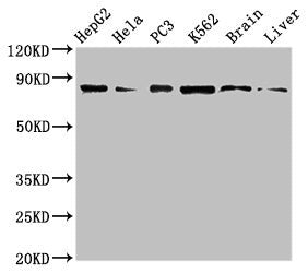 Western Blot Positive WB detected in: HepG2 whole cell lysate, Hela whole cell lysate, PC-3 whole cell lysate, K562 whole cell lyaste, Mouse brain tissue, Rat liver tissue All lanes: STAT4 antibody at 1µg/ml Secondary Goat polyclonal to rabbit IgG...