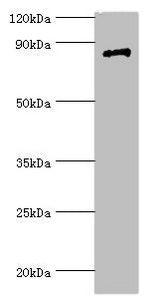 Western blot All lanes: Signal transducer and activator of transcription 4 antibody at 7ug/ml + Jurkat whole cell lysate Secondary Goat polyclonal to rabbit IgG at 1/10000 dilution Predicted band size: 86 kDa Observed band size: 86 kDa