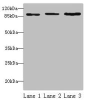 Western blot All lanes: STAT5B antibody at 16 ug/ml Lane 1: HepG2 whole cell lysate Lane 2: K562 whole cell lysate Lane 3: Hela whole cell lysate Secondary Goat polyclonal to rabbit IgG at 1/10000 dilution Predicted band size: 90 kDa Observed band...