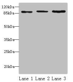 Western blot All lanes: STAT5B antibody at 16 ug/ml Lane 1: HepG2 whole cell lysate Lane 2: K562 whole cell lysate Lane 3: Hela whole cell lysate Secondary Goat polyclonal to rabbit IgG at 1/10000 dilution Predicted band size: 90 kDa Observed band...