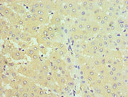 Immunohistochemistry of paraffin-embedded human liver tissue using CSB-PA022821ESR1HU at dilution of 1:100