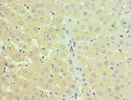 Immunohistochemistry of paraffin-embedded human liver tissue using CSB-PA022821ESR1HU at dilution of 1:100