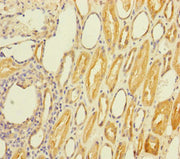 Immunohistochemistry of paraffin-embedded human kidney tissue using CSB-PA022822ESR1HU at dilution of 1:100