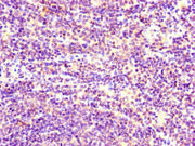 Immunohistochemistry of paraffin-embedded human lymph node tissue using CSB-PA022829LA01HU at dilution of 1:100