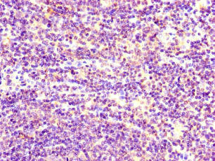 Immunohistochemistry of paraffin-embedded human lymph node tissue using CSB-PA022829LA01HU at dilution of 1:100