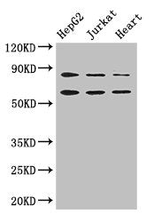 Western Blot Positive WB detected in: HepG2 whole cell lysate, Jurkat whole cell lysate, Mouse heart tissue All lanes: STIM2 antibody at 2.8ug/ml Secondary Goat polyclonal to rabbit IgG at 1/50000 dilution Predicted band size: 84, 94, 69 kDa Obser...