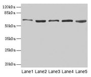 Western blot All lanes: STIP1 antibody at 12µg/ml Lane 1: Hela whole cell lysate Lane 2: HepG2 whole cell lysate Lane 3: NIH/3T3 whole cell lysate Lane 4: Jurkat whole cell lysate Lane 5: Rat gonadal tissue Secondary Goat polyclonal to rabbit IgG...
