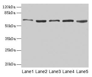 Western blot All lanes: STIP1 antibody at 12µg/ml Lane 1: Hela whole cell lysate Lane 2: HepG2 whole cell lysate Lane 3: NIH/3T3 whole cell lysate Lane 4: Jurkat whole cell lysate Lane 5: Rat gonadal tissue Secondary Goat polyclonal to rabbit IgG...