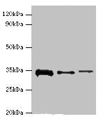 Western blot All lanes: STK16 antibody at 12ug/ml Lane 1: A549 whole cell lysate Lane 2: Mouse brain tissue Lane 3: A431 whole cell lysate Secondary Goat polyclonal to rabbit IgG at 1/10000 dilution Predicted band size: 35 kDa Observed band size:...