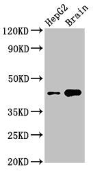 Western Blot Positive WB detected in: HepG2 whole cell lysate, Mouse brain tissue All lanes: STK17B antibody at 3µg/ml Secondary Goat polyclonal to rabbit IgG at 1/50000 dilution Predicted band size: 43 kDa Observed band size: 43 kDa