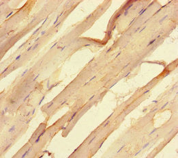 Immunohistochemistry of paraffin-embedded human skeletal muscle tissue using CSB-PA022842LA01HU at dilution of 1:100