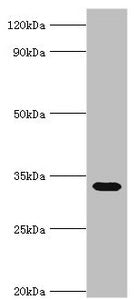 Western blot All lanes: Erythrocyte band 7 integral membrane protein antibody at 5ug/ml + Mouse liver tissue Secondary Goat polyclonal to rabbit IgG at 1/10000 dilution Predicted band size: 32, 14 kDa Observed band size: 32 kDa