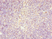 Immunohistochemistry of paraffin-embedded human thymus tissue using CSB-PA022871LA01HU at dilution of 1:100