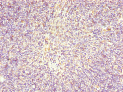 Immunohistochemistry of paraffin-embedded human thymus tissue using CSB-PA022871LA01HU at dilution of 1:100