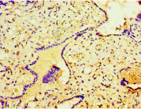 Immunohistochemistry of paraffin-embedded human placenta tissue using CSB-PA022880DSR2HU at dilution of 1:100