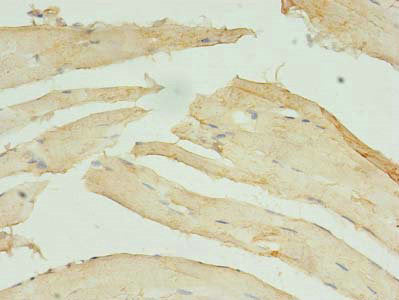 Immunohistochemistry of paraffin-embedded human skeletal muscle tissue using CSB-PA022888HA01HU at dilution of 1:100