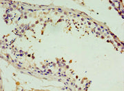 Immunohistochemistry of paraffin-embedded human testis tissue using CSB-PA022889ESR1HU at dilution of 1:100
