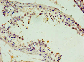 Immunohistochemistry of paraffin-embedded human testis tissue using CSB-PA022889ESR1HU at dilution of 1:100