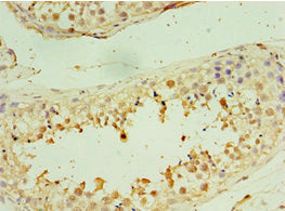 Immunohistochemistry of paraffin-embedded human testis tissue using CSB-PA022891ESR1HU at dilution of 1:100