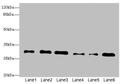 Western blot All lanes: STX7antibody at 2.39ug/ml Lane 1: Mouse brain tissue Lane 2: Mouse spleen tissue Lane 3: Hela whole cell lysate Lane 4: Jurkat whole cell lysate Lane 5: NIH/3T3 whole cell lysate Lane 6: HepG2 whole cell lysate Secondary Go...