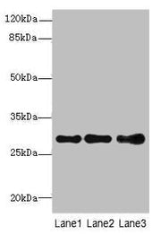 Western blot All lanes: STX7antibody at 1.39ug/ml Lane 1: Mouse spleen tissue Lane 2: Hela whole cell lysate Lane 3: HepG2 whole cell lysate Secondary Goat polyclonal to rabbit IgG at 1/10000 dilution Predicted band size: 30, 28 kDa Observed band...