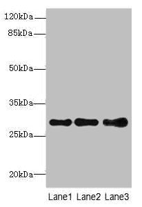 Western blot All lanes: STX7antibody at 1.39ug/ml Lane 1: Mouse spleen tissue Lane 2: Hela whole cell lysate Lane 3: HepG2 whole cell lysate Secondary Goat polyclonal to rabbit IgG at 1/10000 dilution Predicted band size: 30, 28 kDa Observed band...