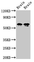 Western Blot Positive WB detected in: Rat brain tissue, Mouse brain tissue All lanes: STXBP1 antibody at 2ug/ml Secondary Goat polyclonal to rabbit IgG at 1/50000 dilution Predicted band size: 68, 69 kDa Observed band size: 68, 69 kDa