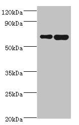 Western blot All lanes: STXBP3 antibody at 10ug/ml Lane 1: HepG2 whole cell lysate Lane 2: K562 whole cell lysate Secondary Goat polyclonal to rabbit IgG at 1/10000 dilution Predicted band size: 68 kDa Observed band size: 68 kDa