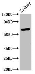 Western Blot Positive WB detected in: Mouse kidney tissue All lanes: STXBP3 antibody at 3.4ug/ml Secondary Goat polyclonal to rabbit IgG at 1/50000 dilution Predicted band size: 68 kDa Observed band size: 68 kDa
