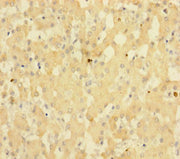Immunohistochemistry of paraffin-embedded human liver tissue using CSB-PA022915HA01HU at dilution of 1:100