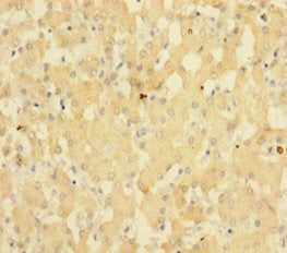 Immunohistochemistry of paraffin-embedded human liver tissue using CSB-PA022915HA01HU at dilution of 1:100