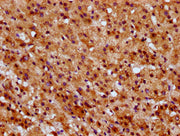 IHC image of CSB-PA022919LA01HU diluted at 1:600 and staining in paraffin-embedded human adrenal gland tissue performed on a Leica BondTM system. After dewaxing and hydration, antigen retrieval was mediated by high pressure in a citrate buffer (pH...