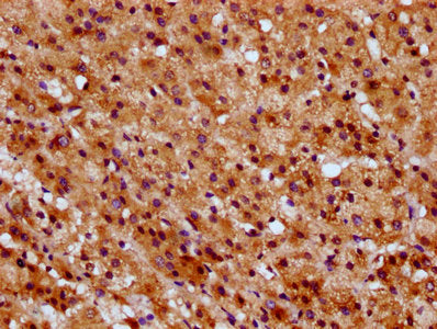 IHC image of CSB-PA022919LA01HU diluted at 1:600 and staining in paraffin-embedded human adrenal gland tissue performed on a Leica BondTM system. After dewaxing and hydration, antigen retrieval was mediated by high pressure in a citrate buffer (pH...