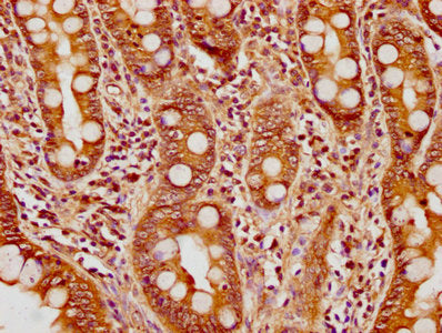 IHC image of CSB-PA022934LA01HU diluted at 1:200 and staining in paraffin-embedded human small intestine tissue performed on a Leica BondTM system. After dewaxing and hydration, antigen retrieval was mediated by high pressure in a citrate buffer (...