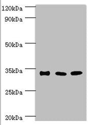Western blot All lanes: Sulfotransferase 1A3 antibody at 10ug/ml Lane 1: A549 whole cell lysate Lane 2: Mouse liver tissue Lane 2: Mouse kidney tissue Secondary Goat polyclonal to rabbit IgG at 1/10000 dilution Predicted band size: 35, 23 kDa Obse...