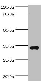 Western blot All lanes: Sulfotransferase 1A3 antibody at 7ug/ml + A549 whole cell lysate Secondary Goat polyclonal to rabbit IgG at 1/10000 dilution Predicted band size: 35, 23 kDa Observed band size: 35 kDa