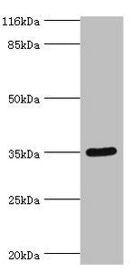 Western blot All lanes: SULT1B1 antibody at 24µg/ml + Mouse small intestine tissue Secondary Goat polyclonal to rabbit IgG at 1/10000 dilution Predicted band size: 35 kDa Observed band size: 35 kDa