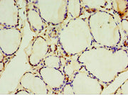 Immunohistochemistry of paraffin-embedded human thyroid tissue using CSB-PA022938ESR1HU at dilution of 1:100
