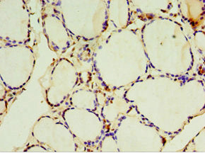 Immunohistochemistry of paraffin-embedded human thyroid tissue using CSB-PA022938ESR1HU at dilution of 1:100