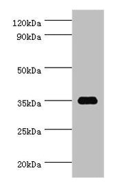 Western blot All lanes: SULT1C2 antibody at 5ug/ml + Hela whole cell lysate Secondary Goat polyclonal to rabbit IgG at 1/10000 dilution Predicted band size: 35, 36 kDa Observed band size: 35 kDa