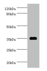 Western blot All lanes: SULT1C2 antibody at 5ug/ml + Hela whole cell lysate Secondary Goat polyclonal to rabbit IgG at 1/10000 dilution Predicted band size: 35, 36 kDa Observed band size: 35 kDa