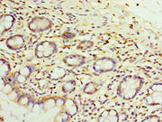 Immunohistochemistry of paraffin-embedded human small intestine tissue using CSB-PA022941ESR1HU at dilution of 1:100