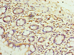 Immunohistochemistry of paraffin-embedded human small intestine tissue using CSB-PA022941ESR1HU at dilution of 1:100
