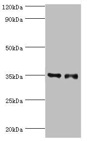 Western blot All lanes: Estrogen sulfotransferase antibody at 7ug/ml Lane 1: Mouse lung tissue Lane 2: Mouse liver tissue Secondary Goat polyclonal to rabbit IgG at 1/10000 dilution Predicted band size: 35, 30 kDa Observed band size: 35 kDa