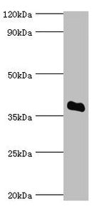 Western blot All lanes: Bile salt sulfotransferase antibody at 5ug/ml + HepG2 whole cell lysate Secondary Goat polyclonal to rabbit IgG at 1/10000 dilution Predicted band size: 38 kDa Observed band size: 38 kDa