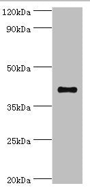 Western blot All lanes: Sulfotransferase family cytosolic 2B member 1 antibody at 4ug/ml + MCF-7 whole cell lysate Secondary Goat polyclonal to rabbit IgG at 1/10000 dilution Predicted band size: 42, 40 kDa Observed band size: 42 kDa
