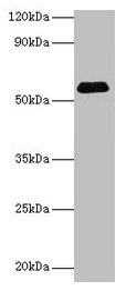 Western blot All lanes: SUOX antibody at 2µg/ml + Rat liver tissue Secondary Goat polyclonal to rabbit IgG at 1/15000 dilution Predicted band size: 61 kDa Observed band size: 61 kDa