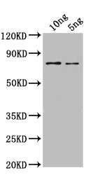 Western Blot Positive WB detected in: recombinant protein All lanes: SPT16 Antibody at 1:1000 Secondary Goat polyclonal to rabbit IgG at 1/50000 dilution Predicted band size: 65 kDa Observed band size: 65 kDa