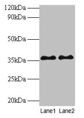 Western blot All lanes: SUPT3H antibody at 2µg/ml Lane 1: Mouse brain tissue Lane 2: Colo320 whole cell lysate Secondary Goat polyclonal to rabbit IgG at 1/10000 dilution Predicted band size: 36, 38 kDa Observed band size: 36 kDa